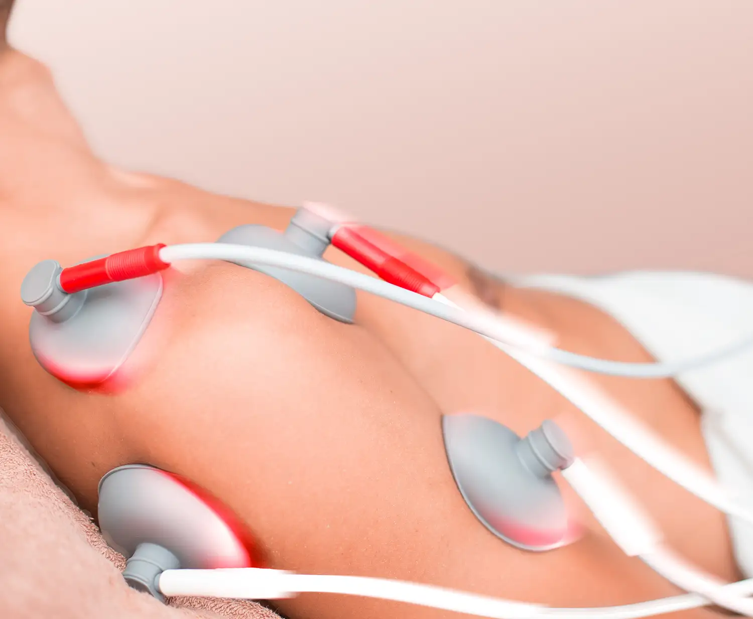 Elektroterapie - Day1